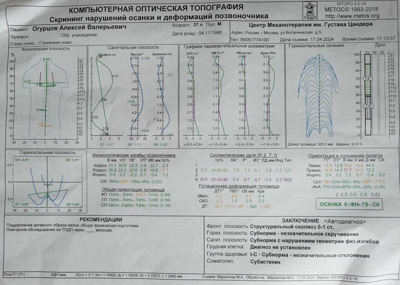 Механотерапия 2